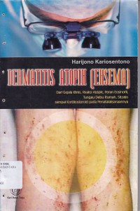 DERMATIS APOTIK (EKSEMA)